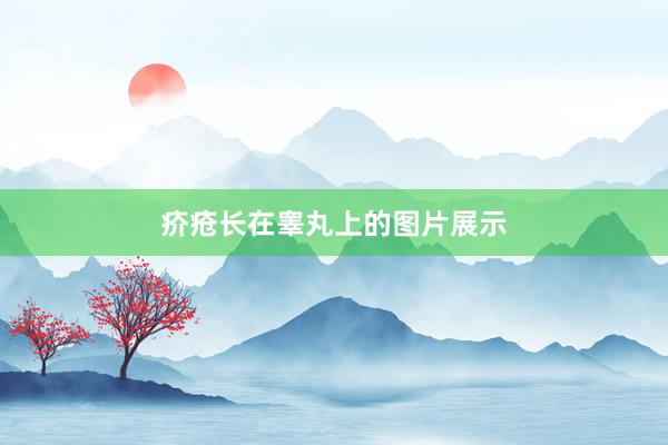 疥疮长在睾丸上的图片展示